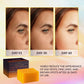 VALITIC Kojic Acid Dark Spot Remover Soap Bars, Turmeric Bar Soaps 4 Pack