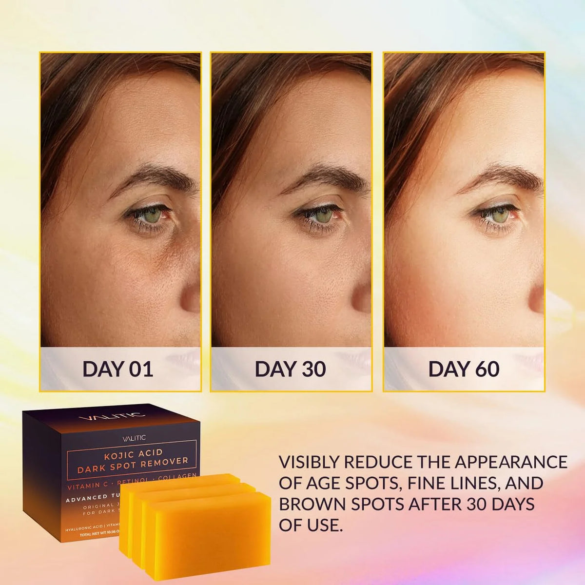 VALITIC Kojic Acid Dark Spot Remover Soap Bars, Turmeric Bar Soaps 4 Pack