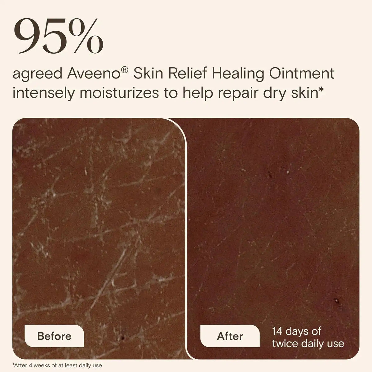 Aveeno Skin Relief Healing Ointment, Fragrance-Free, 2 Ounce (Pack of 12)
