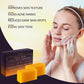 VALITIC Kojic Acid Dark Spot Remover Soap Bars, Turmeric Bar Soaps 4 Pack