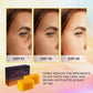 VALITIC Kojic Acid Dark Spot Remover Soap Bars, Turmeric Bar Soaps 4 Pack