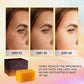 VALITIC Kojic Acid Dark Spot Remover Soap Bars, Turmeric Bar Soaps 4 Pack