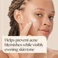 Aveeno Positively Radiant Clear Complexion Acne Face Moisturizer, 4 fl. oz